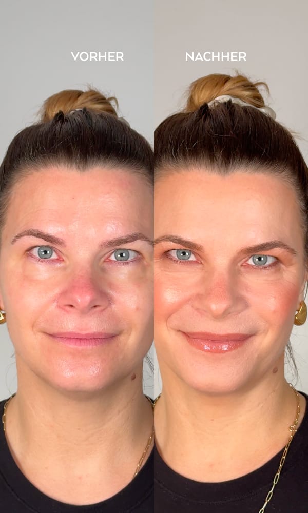 Vorher Nachher The elevated Nude Look